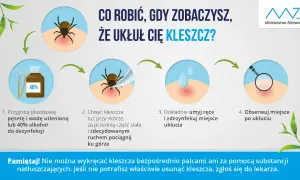 Jak wyjąć kleszcza domowym sposobem: przygotuj pęsetę i alkohol, chwyć kleszcza blisko skóry i pociągnij, umyj ręce i miejsce ukłucia, obserwuj.