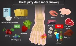 Dieta przy dnie moczanowej: co pić? Zalecane: nabiał niskotłuszczowy, chleb pełnoziarnisty, warzywa, wiśnie, czarne jagody. Unikaj: drobiu, łososia, tuńczyka, czerwonego mięsa, owoców morza, podrobów, alkoholu.