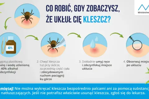 Jak wyjąć kleszcza domowym sposobem: przygotuj pęsetę i alkohol, chwyć kleszcza blisko skóry i pociągnij, umyj ręce i miejsce ukłucia, obserwuj.
