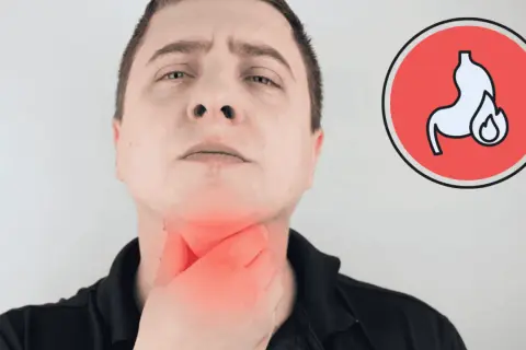 Mężczyzna trzyma się za gardło, odczuwając pieczenie. Obok symbol żołądka z ogniem, sugerujący, czy przy refluksie jest kaszel.