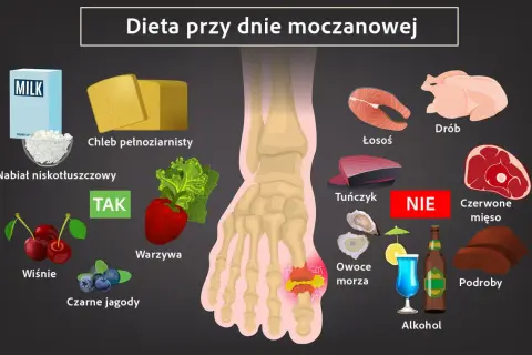 Dieta przy dnie moczanowej: co pić? Zalecane: nabiał niskotłuszczowy, chleb pełnoziarnisty, warzywa, wiśnie, czarne jagody. Unikaj: drobiu, łososia, tuńczyka, czerwonego mięsa, owoców morza, podrobów, alkoholu.