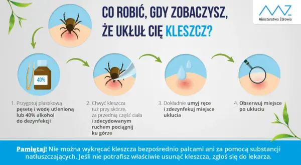 Jak wyjąć kleszcza domowym sposobem: przygotuj pęsetę i alkohol, chwyć kleszcza blisko skóry i pociągnij, umyj ręce i miejsce ukłucia, obserwuj.