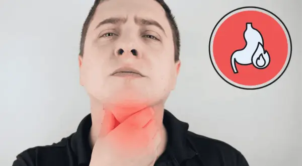 Mężczyzna trzyma się za gardło, odczuwając pieczenie. Obok symbol żołądka z ogniem, sugerujący, czy przy refluksie jest kaszel.