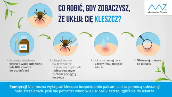 Jak wyjąć kleszcza domowym sposobem: przygotuj pęsetę i alkohol, chwyć kleszcza blisko skóry i pociągnij, umyj ręce i miejsce ukłucia, obserwuj.