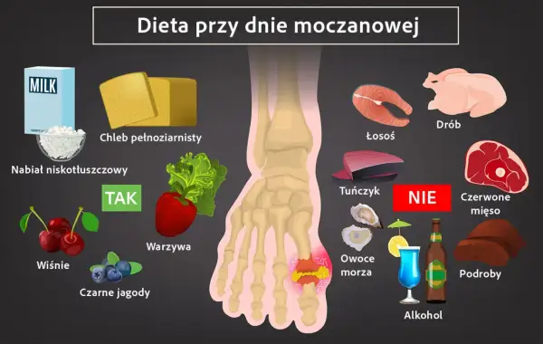 Dieta przy dnie moczanowej: co pić? Zalecane: nabiał niskotłuszczowy, chleb pełnoziarnisty, warzywa, wiśnie, czarne jagody. Unikaj: drobiu, łososia, tuńczyka, czerwonego mięsa, owoców morza, podrobów, alkoholu.